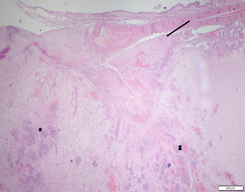 pathologie