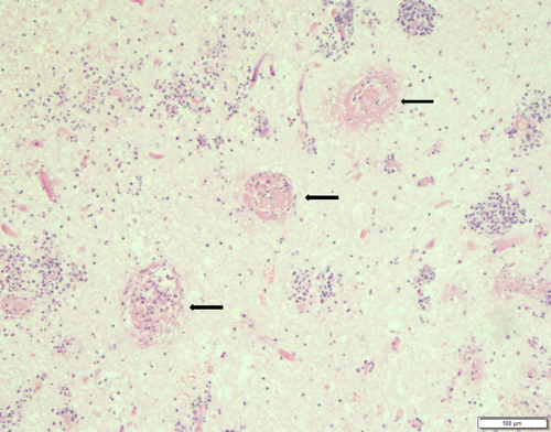 pathologie